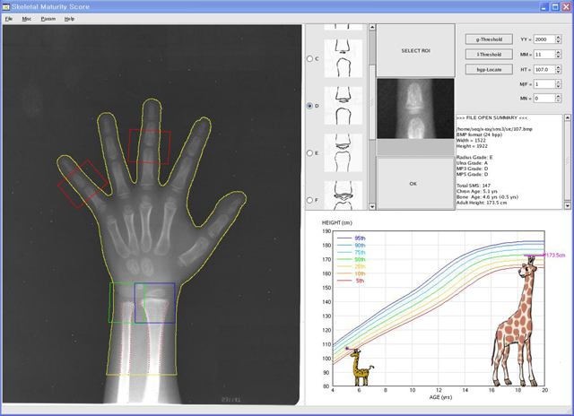 New software predicts 'how tall my child will be', (Photo) Main page of the new software for predicting children's future growth