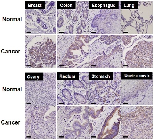 Chungnam National University proferssor identifies Cancer-triggering substance