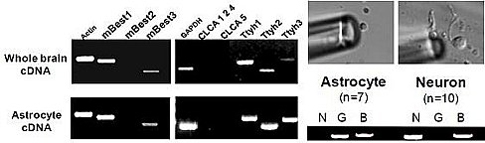 Bestrophin genes exist in the brain cells, and are generated extensively in astrocytes in particular through a DNA amplification test