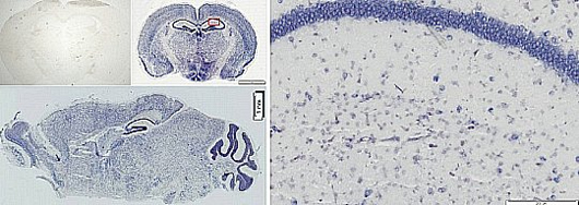 Bestrophin genes are generated in astrocytes in mouse brain cross-sections, as presented through an immuno-staining experiment 