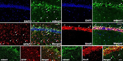 This picture shows the distribution of Bestrophin generated in mouse brain cross-sections through an experiment called 